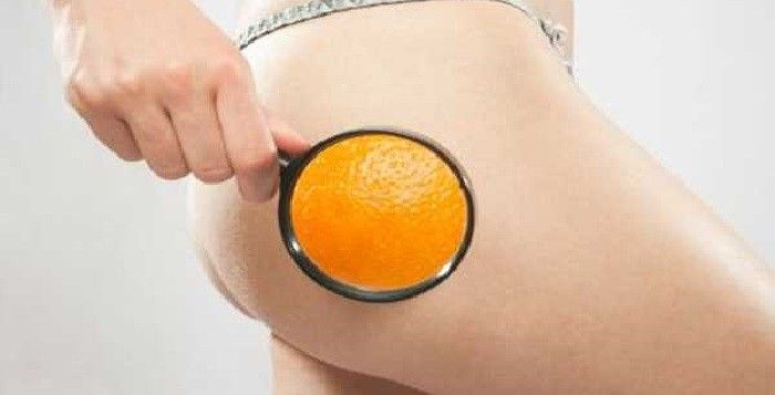 Astuces Pour Combattre La Cellulite Pictures to pin on Pinterest