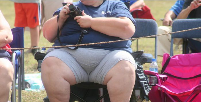 opération des genoux des personnes obèses
