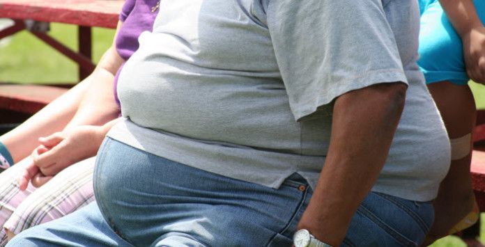 Obésité massive, que faire Obésité massive, que faire