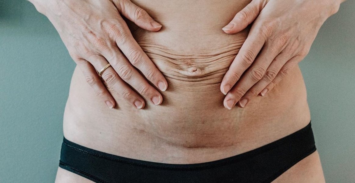 Fond Deux Photos Avec Trois Tailles Différentes Du Ventre Dune Femme Fond,  Photos De Ventres De Femmes Enceintes Après Une Abdominoplastie, Ventre,  Enceinte Image de Fond Pour le Téléchargement Gratuit - Pngtree