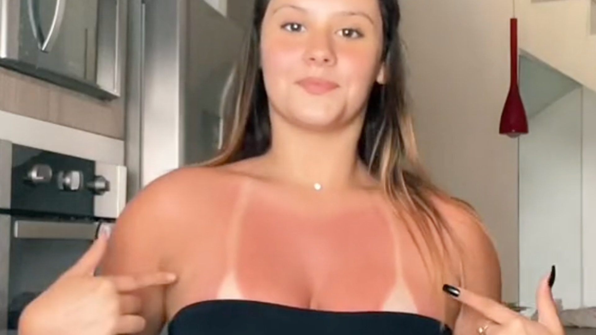 Astuce bronzage néfaste