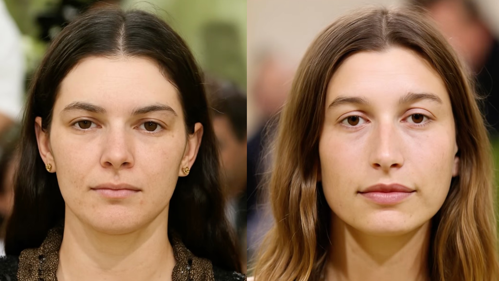 Stars sans chirurgie apparence réelle