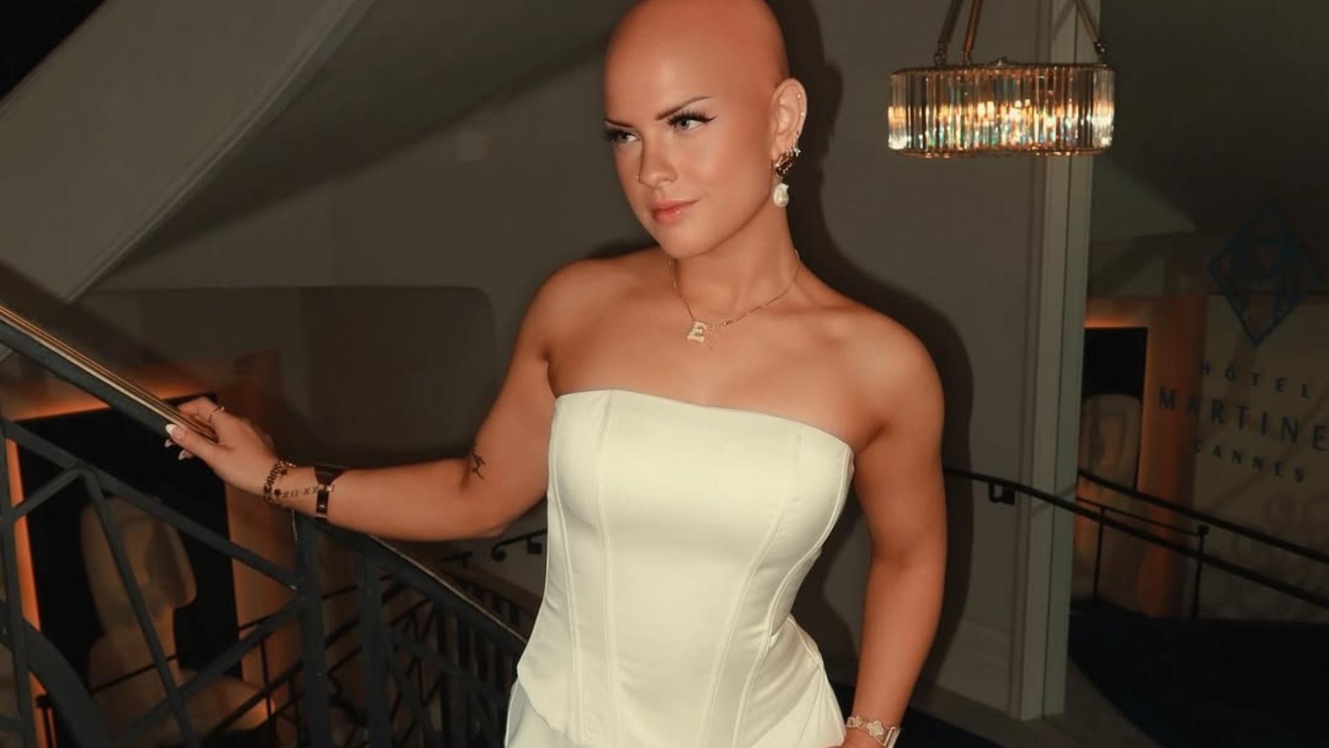 alopécie rayonner sans cheveux